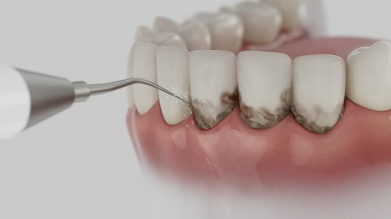 Reliable Dental contractor in Vaughn, WA by Dentist Open Now